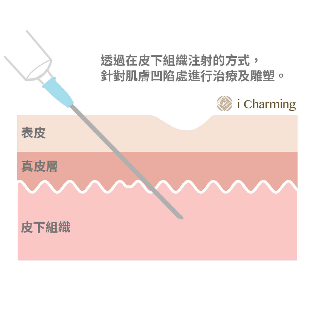 北安勤美晶亮瓷治療過程-1